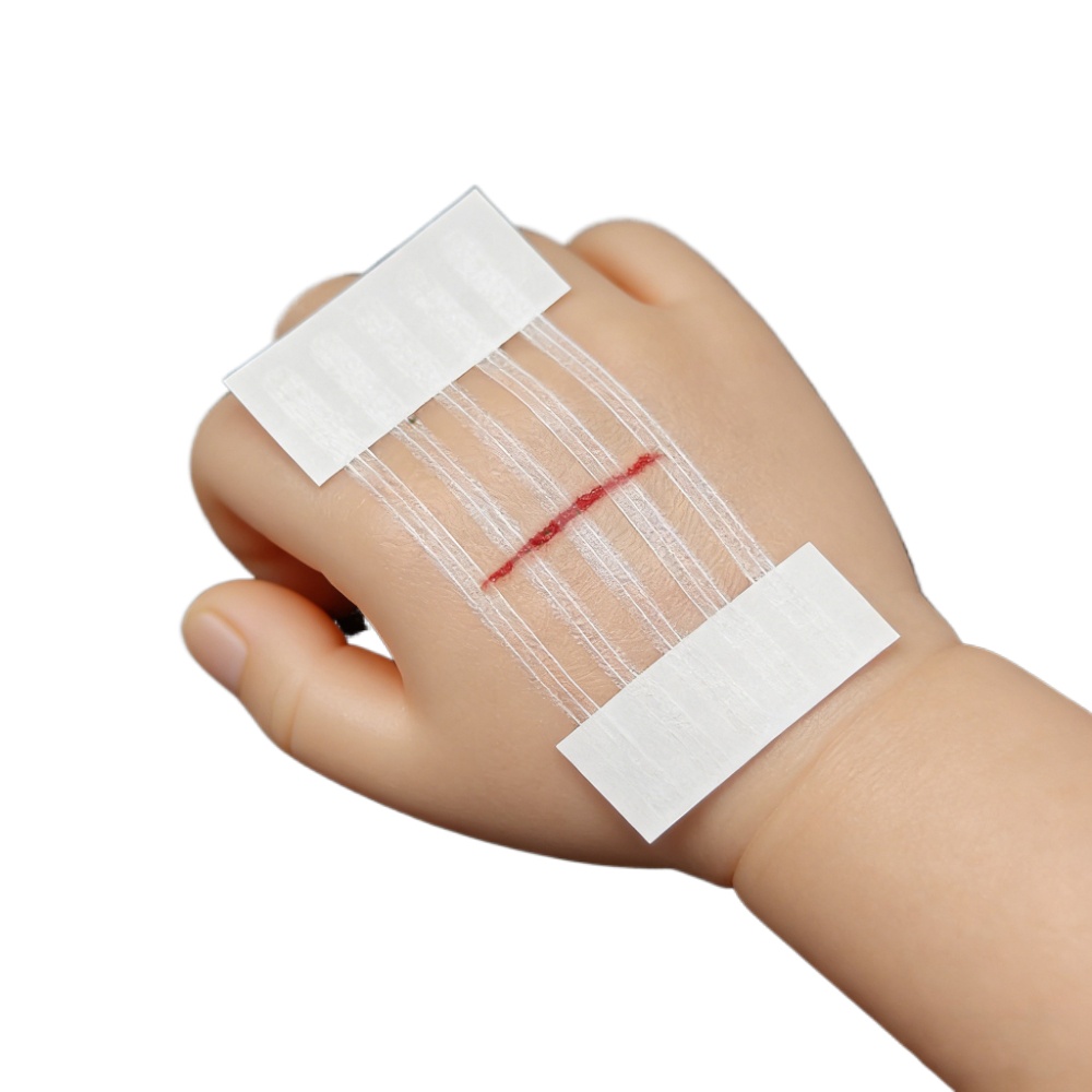 5 Strips Wound Skin Closure St - Medical Label ulasan dan harga