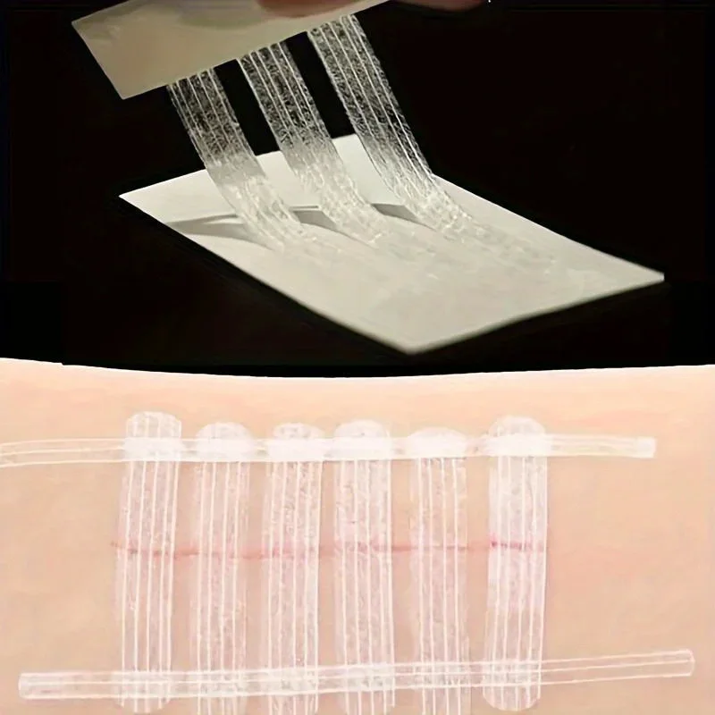 5 Strips Wound Skin Closure St - Medical Label ulasan dan harga