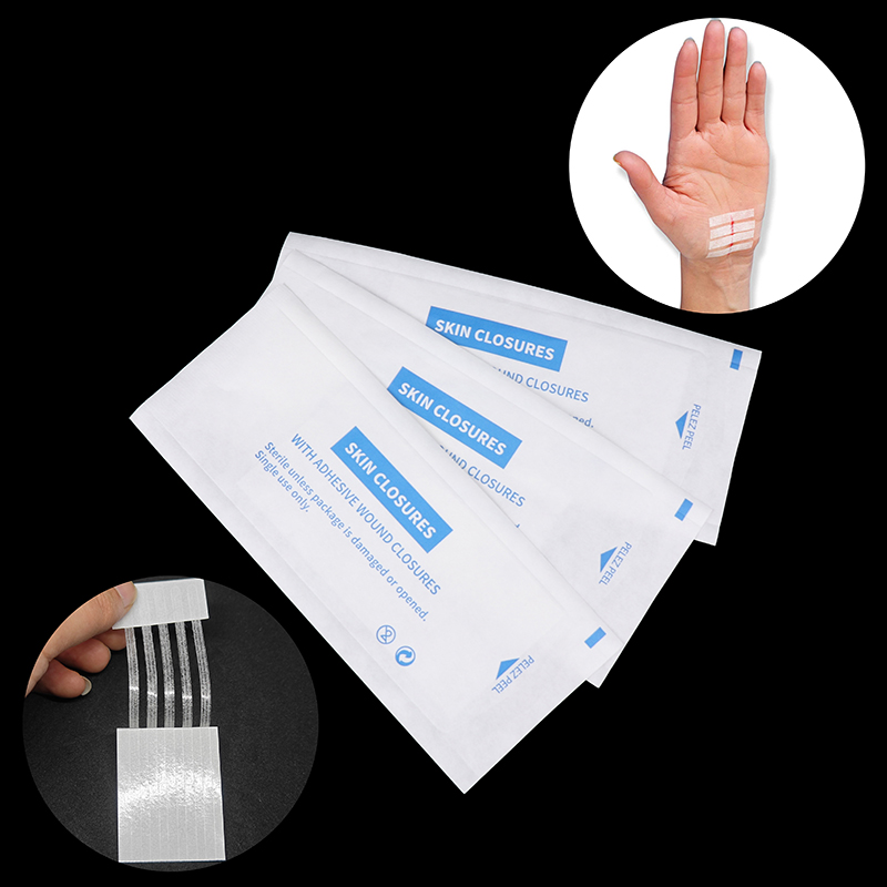 Sterile Strip Scar Away Acne S - Medical Label ulasan dan harga